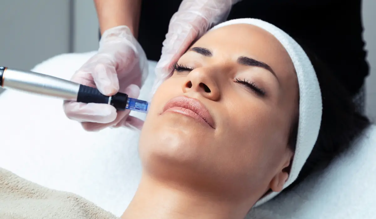 microneedling séance gros plan