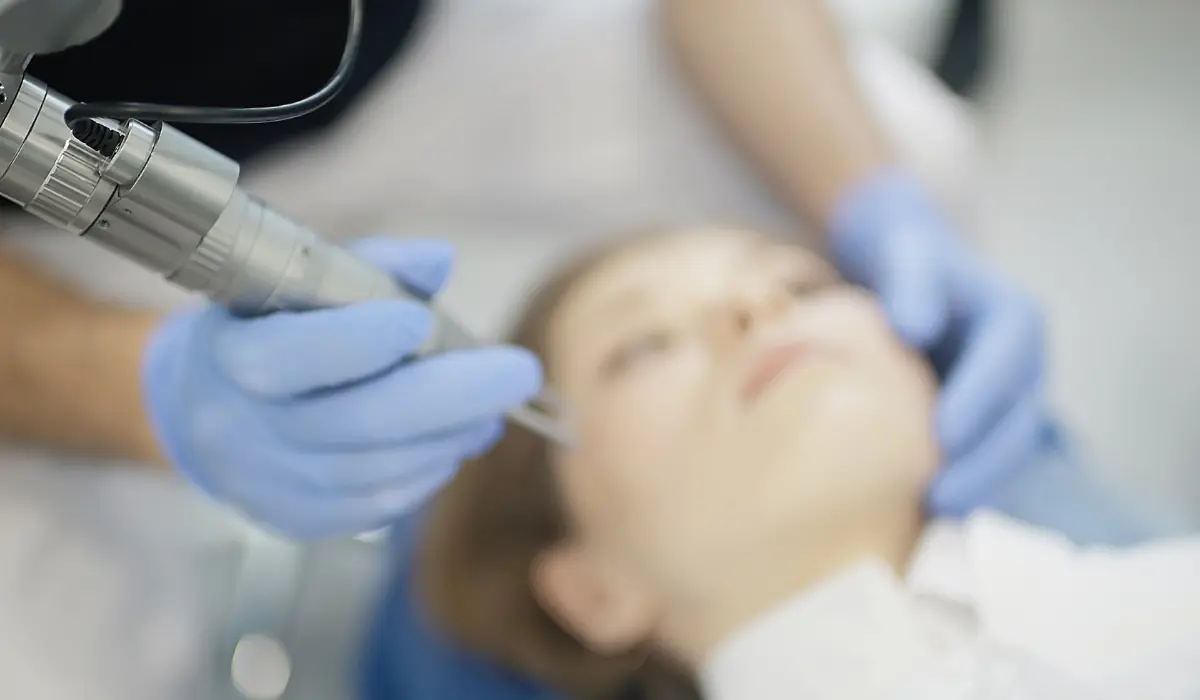 epilation laser visage