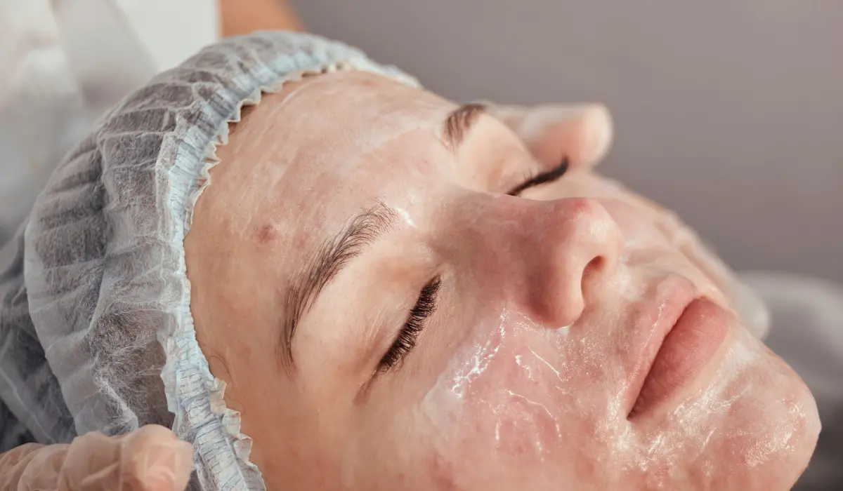 Femme blanche suite séance de médecine esthétique, séance d'application de cosmétique