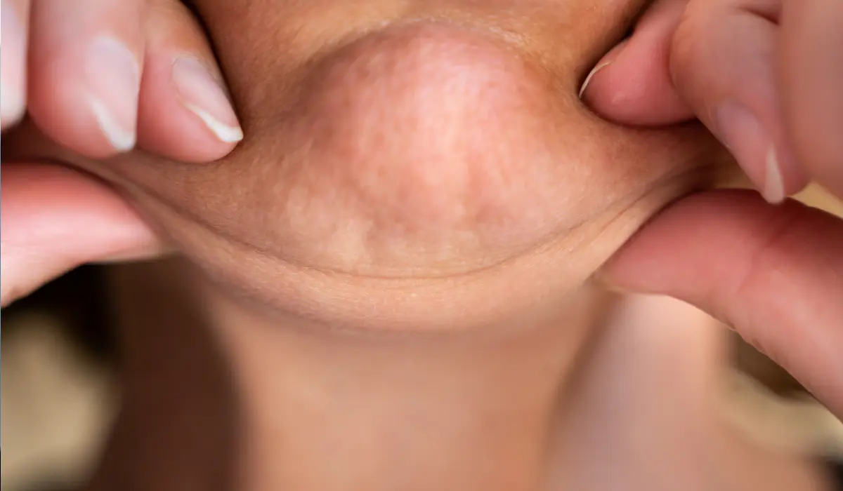 Femme avec un petit double menton