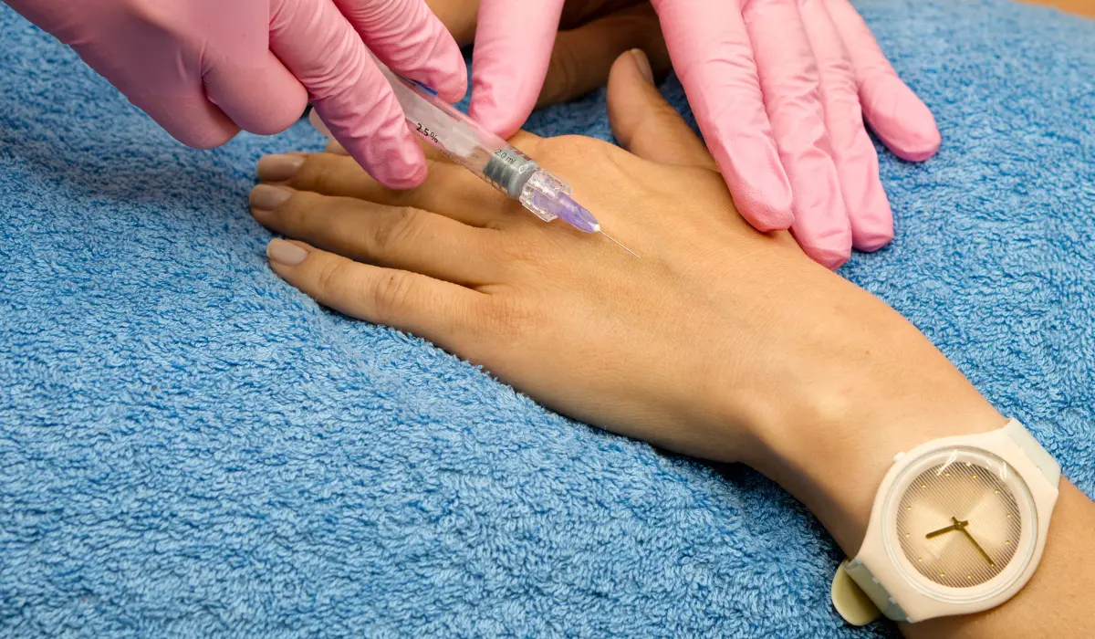 rajeunissement des mains de femme, via une injection de botox