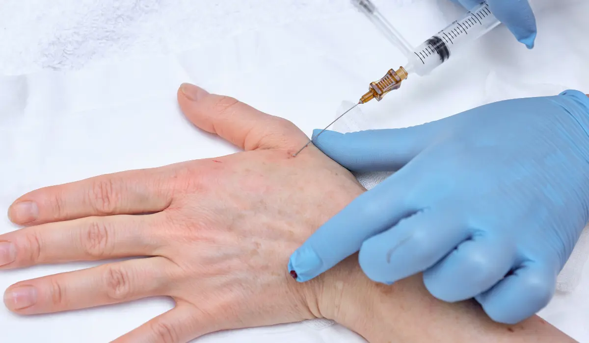 rajeunissement des mains d'un homme, via une injection de botox
