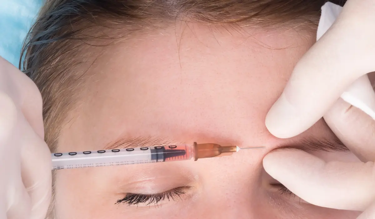 injection botox dans le front