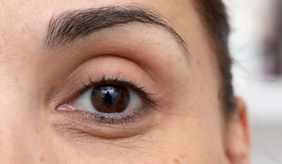 cernes sous les yeux